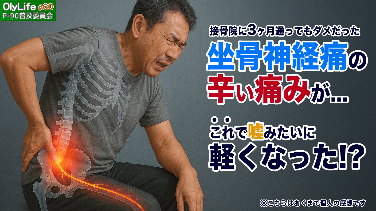 60】【体験談紹介】接骨院に3ヶ月通ってもダメだった坐骨神経痛の”辛い